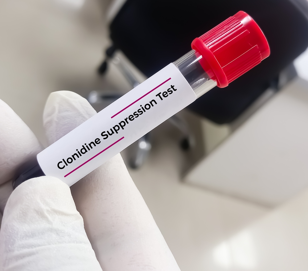 Clonidine-test-tube