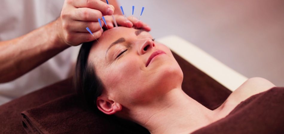 woman taking Acupuncture therapy