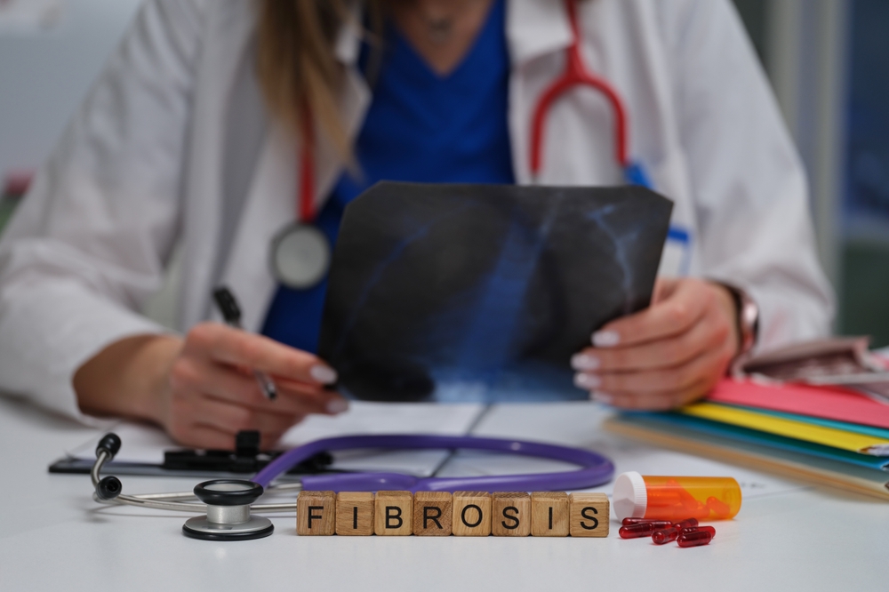 Lady doctor with Fibrosis scan
