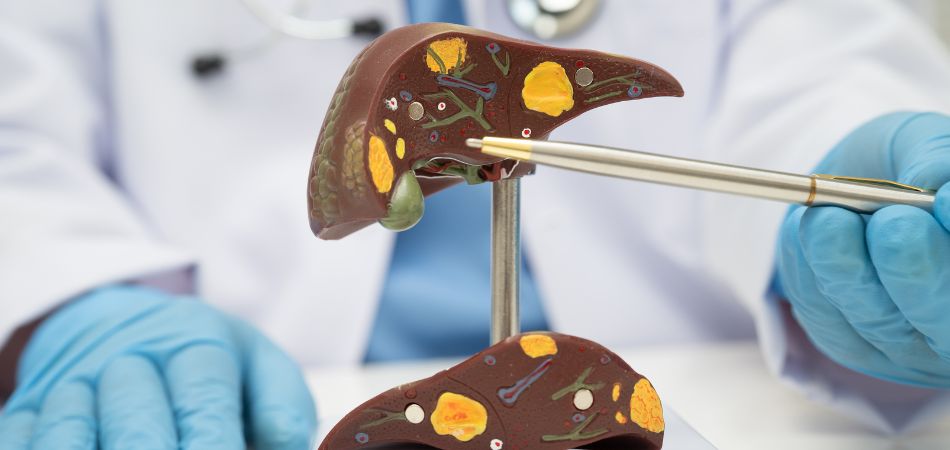 Liver Cirrhosis because of alcohol