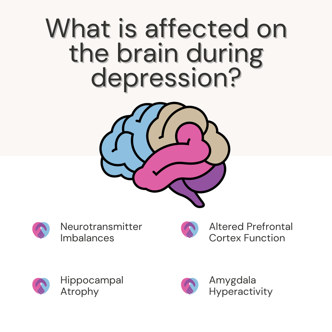 Brain depression symptoms